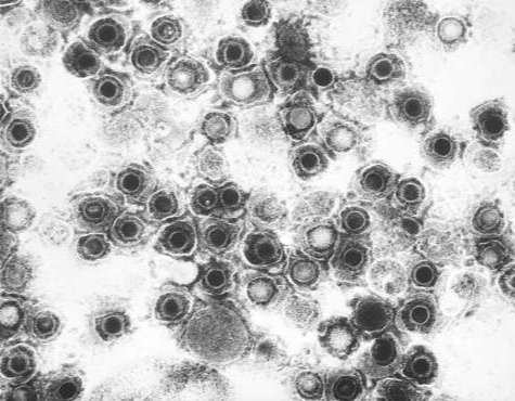 Streptococcus pyogenes serotype M3 DNA repair protein recO (recO) -E. coli