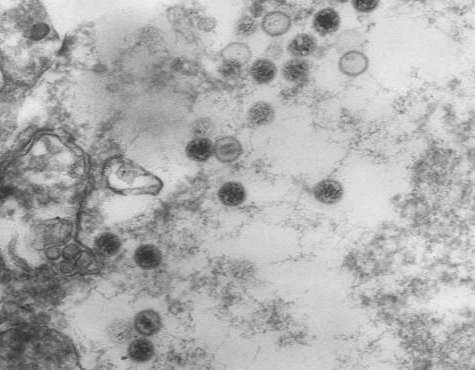 Enterobacteria phage T4 DNA alpha-glucosyltransferase (agt) -Baculovirus