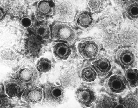 Streptococcus pneumoniae Uracil-DNA glycosylase (ung) -Baculovirus